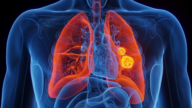 Johns Hopkins announces new blood test for early lung cancer detection